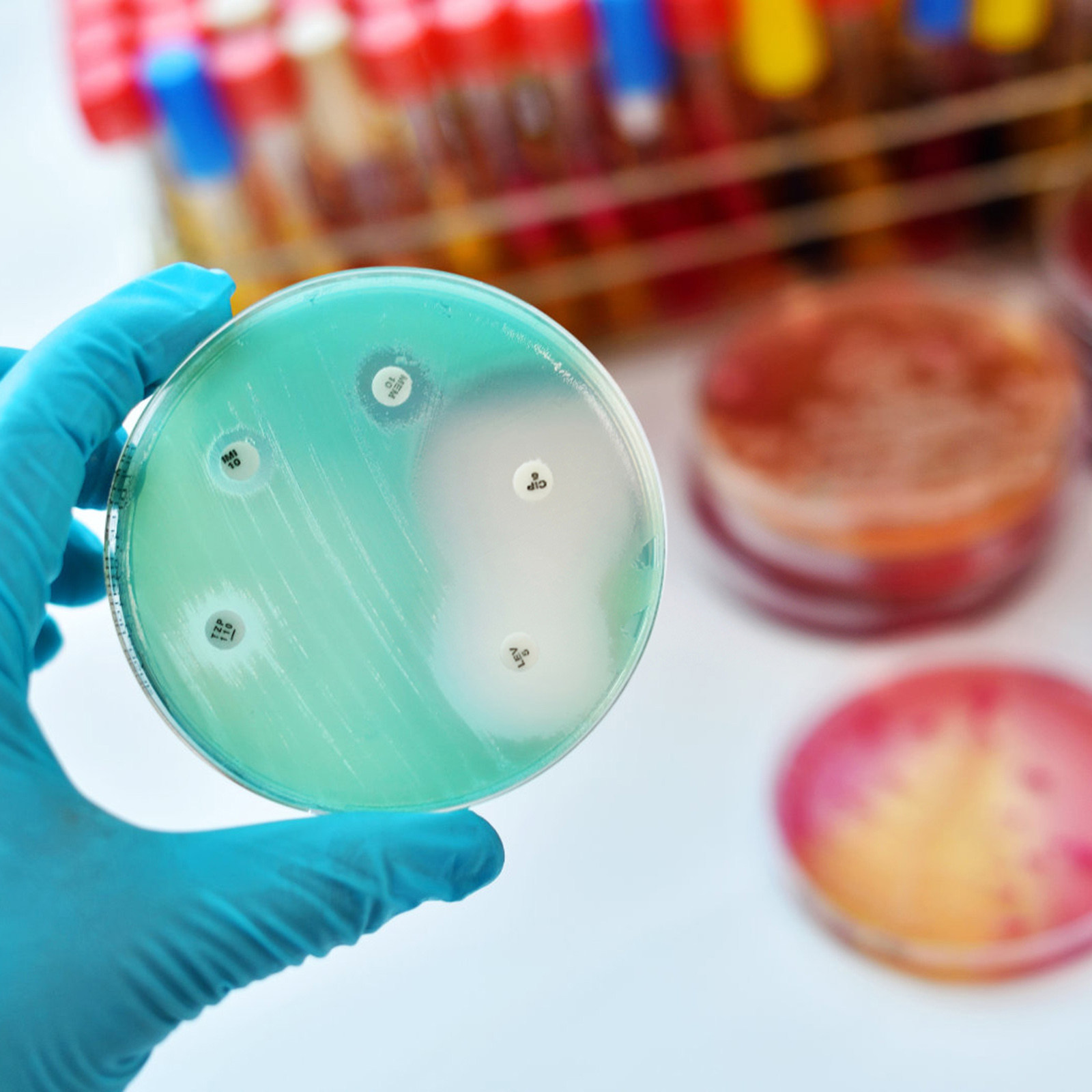 30Pcs Petri Dishes Plastic Cle - Agar Tissue Culture 评论和价格